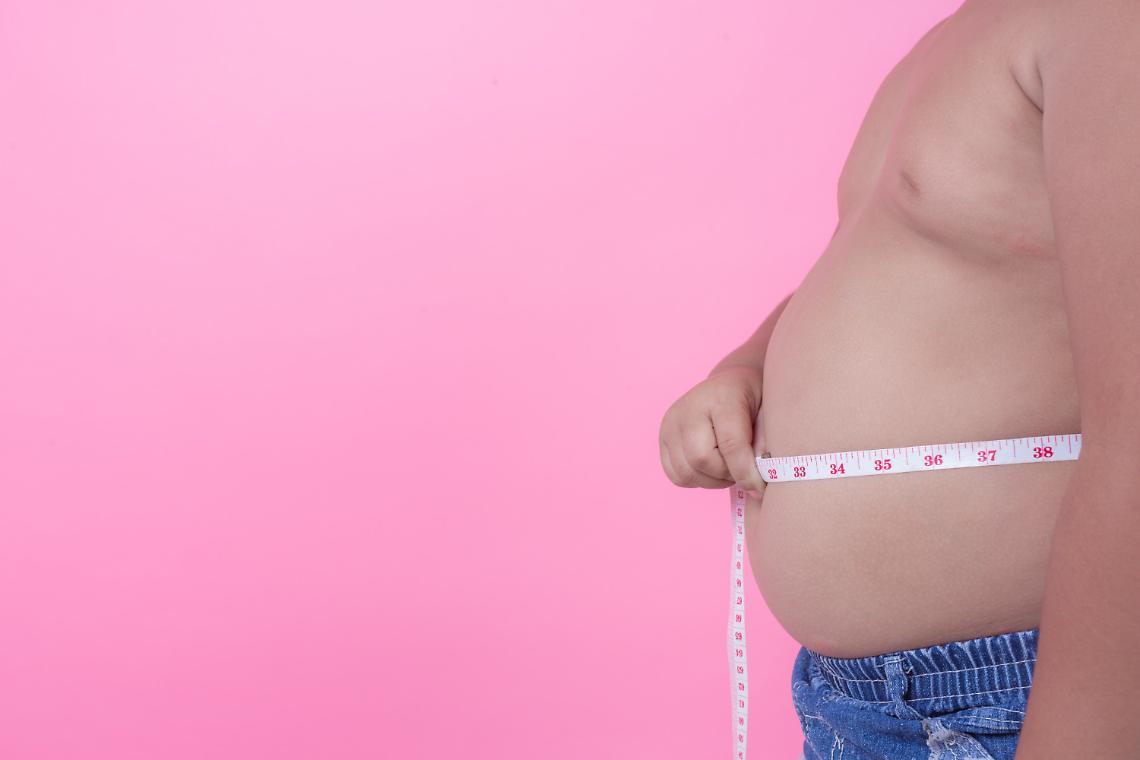 obesità infantile bambino