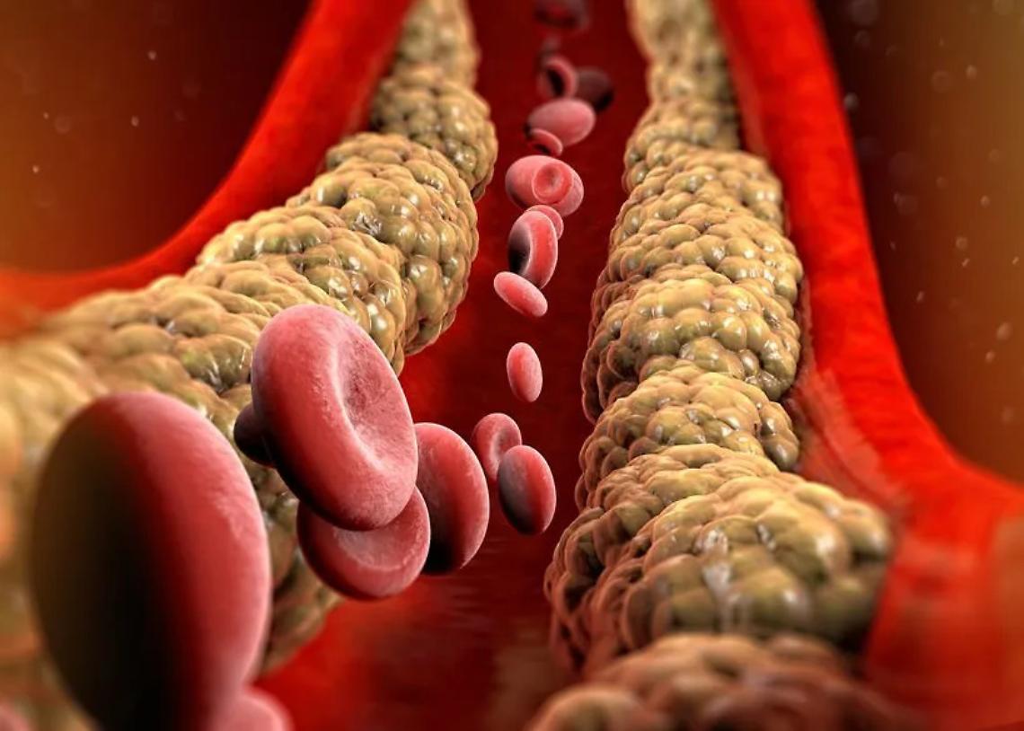 Colesterolo: nemico o alleato? La verità che non ti aspetti