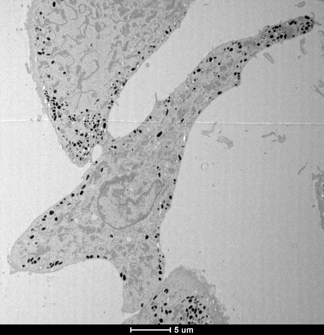 Melanosomi sotto controllo: scoperto il ruolo chiave di MFF