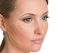 Lifting facile e mininvasivo con Silhouette Soft