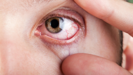 Cosa succede quando il diabete colpisce gli occhi