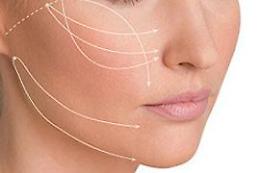 Lifting non chirurgico con i fili Silhouette Soft