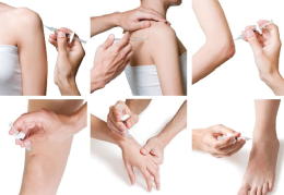 Proloterapia: tutto quello  che c’è da sapere sui trattamenti