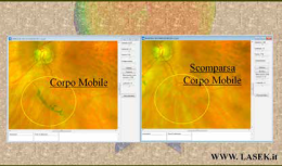 Vitreolisi: trattamento per corpi mobili, miodesopsie, "mosche volanti"