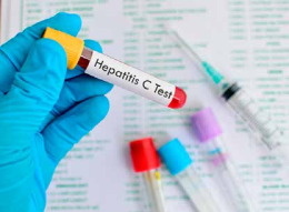 Epatite C, in Veneto si combatte con efficacia per sradicare il virus