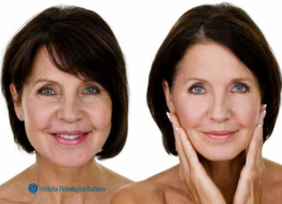 “GLASS SKIN”: una pelle luminosa, perfetta e compatta ad effetto lifting senza chirurgia