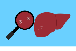 Il ruolo della Elastometria Epatica nella Sindrome Metabolica