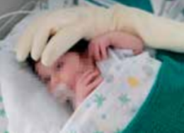 Tra le braccia di Zaky. Il guanto che coccola i bambini nati prematuri, come mamma e papà