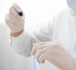 Vaiolo delle scimmie in Veneto: nessuna emergenza, ma è fondamentale l’identificazione di nuovi casi