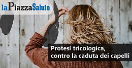 Protesi tricologica: contro la caduta dei capelli