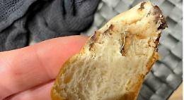 Spinea, graffette nel pane al cioccolato: tre bambini finiscono in ospedale 

