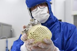Primo intervento in Veneto con cuore completamente artificiale, il Policlinico di Verona annuncia la dimissione del paziente