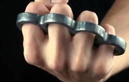 Aggressione a Treviso: anziano prova a fermare il ladro d'auto e viene massacrato con un tirapugni