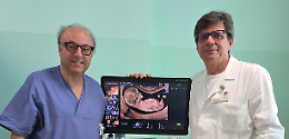 Montebelluna, un nuovo servizio per le future mamme: al via lo screening genetico fetale del primo trimestre