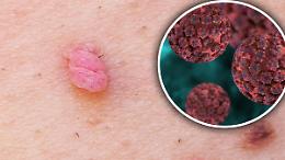 Verona e provincia unite contro le malattie sessualmente trasmissibili con test gratuiti e consulenze in tutto il territorio