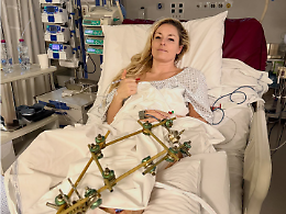 Lyndsey Vonn dimessa dal Ca' Foncello: torna negli Stati Uniti dopo quattro interventi alla gamba