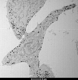 Melanosomi sotto controllo: scoperto il ruolo chiave di MFF