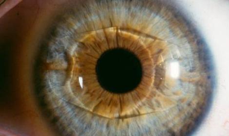 Settimana del glaucoma, visite gratuite in camper dall&rsquo;8 al 14 marzo