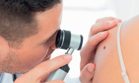 bioanalisi dermatologia