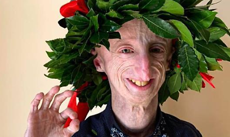 Tezze sul Brenta: il cuore di Sammy Basso raccontato in un libro commovente