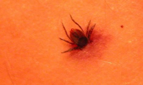 Zanzare e zecche: fastidi estivi che possono diventare pericolosi