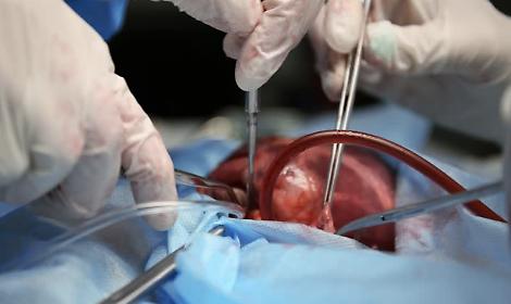 Donazioni di organi in Veneto: cresce il rifiuto, Pasqualon presenta una mozione per invertire la tendenza