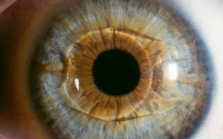 Settimana del glaucoma, visite gratuite in camper dall&rsquo;8 al 14 marzo